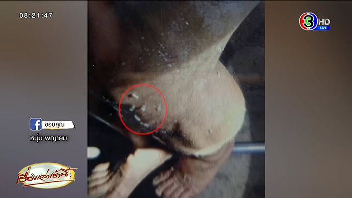 ชายหาหน่อไม้ในป่า กลับมาป่วยประหลาด ชายหาหน่อไม้ในป่า กลับมาป่วยประหลาด