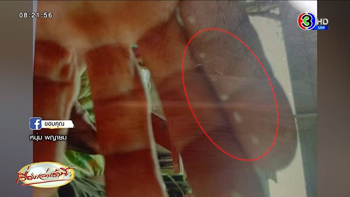 ชายหาหน่อไม้ในป่า กลับมาป่วยประหลาด ชายหาหน่อไม้ในป่า กลับมาป่วยประหลาด