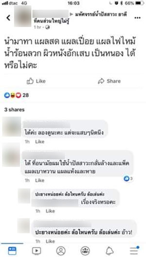 พยาบาลใช้ฉี่ทาแผลคนไข้ พยาบาลใช้ฉี่ทาแผลคนไข้