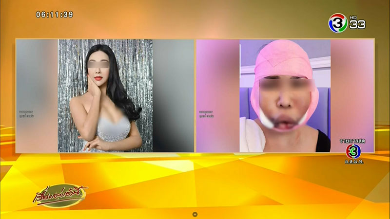 หมอกระเป๋า หมอกระเป๋า