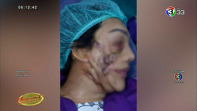 หมอกระเป๋า หมอกระเป๋า