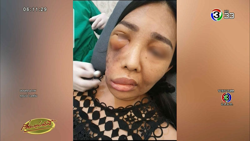 หมอกระเป๋า หมอกระเป๋า