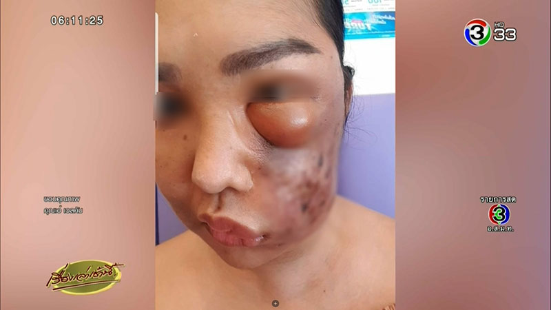 หมอกระเป๋า หมอกระเป๋า