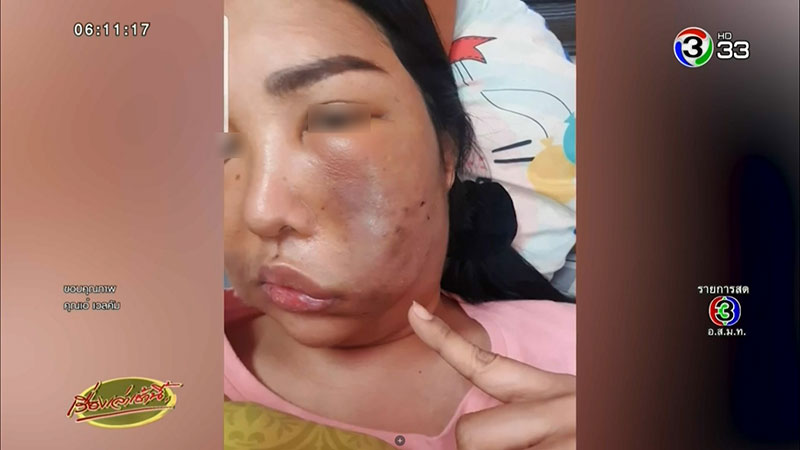 หมอกระเป๋า หมอกระเป๋า