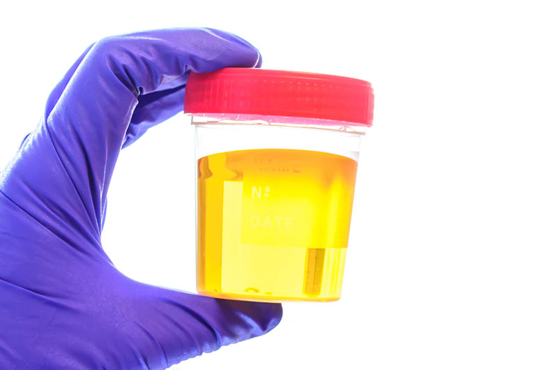 พยาบาล พยาบาล