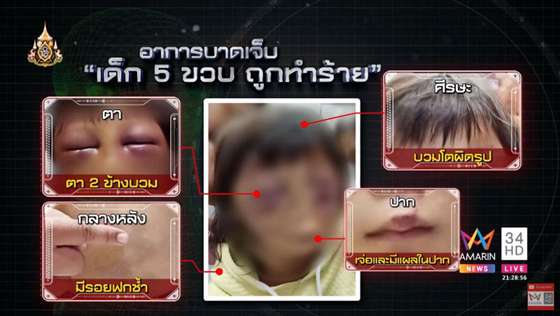 คดีพลิก คดีพลิก