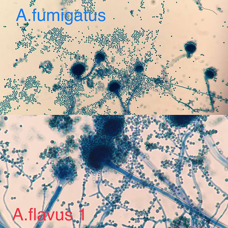 เตือนระวังสุขภาพ เตือนระวังสุขภาพ