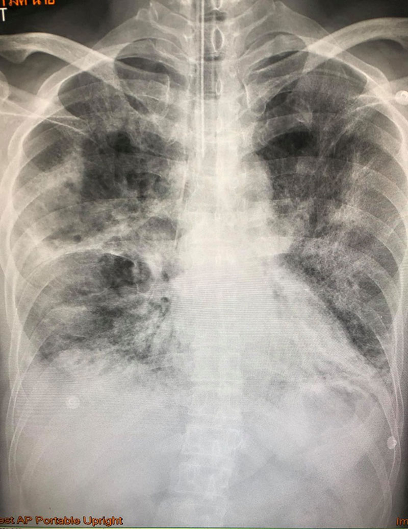 เตือนระวังสุขภาพ เตือนระวังสุขภาพ