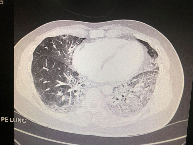 เตือนระวังสุขภาพ เตือนระวังสุขภาพ