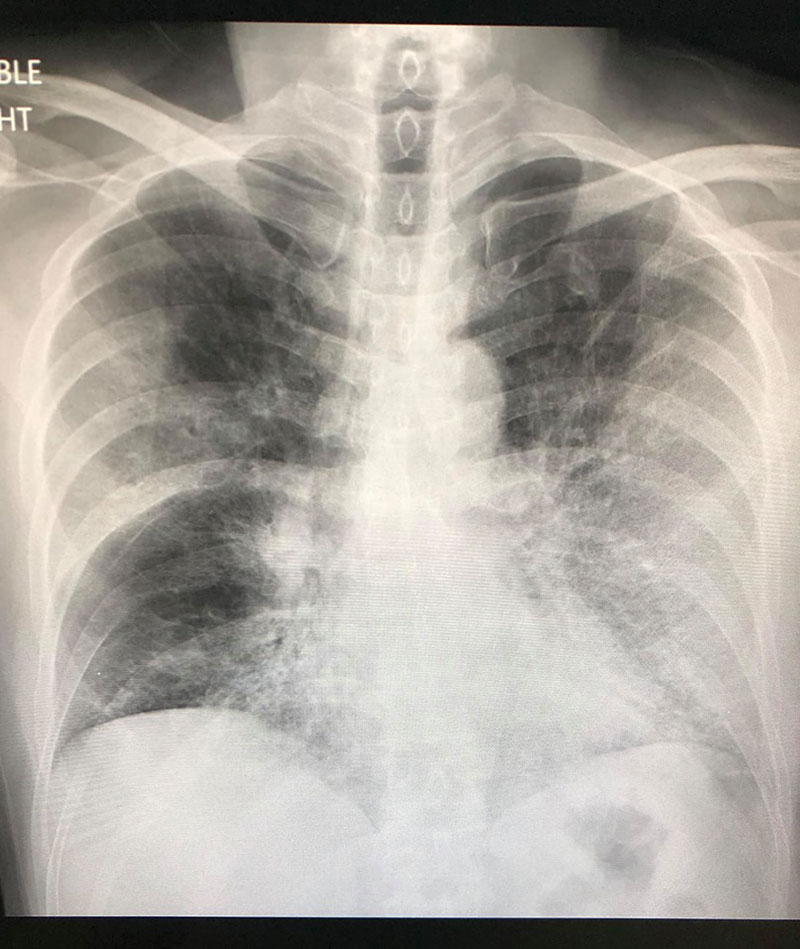 เตือนระวังสุขภาพ เตือนระวังสุขภาพ