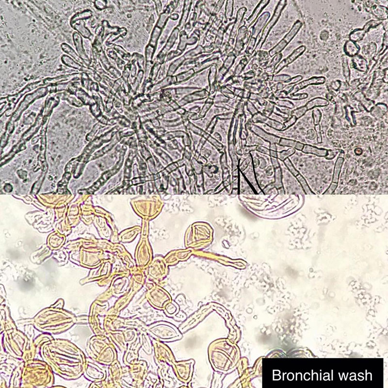 เตือนระวังสุขภาพ เตือนระวังสุขภาพ