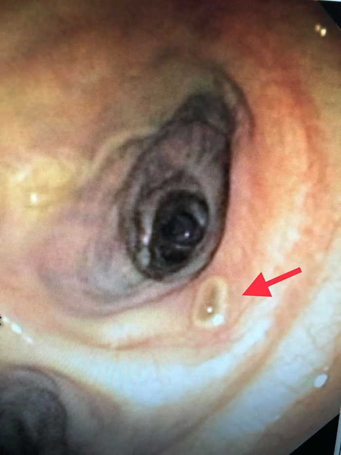 เตือนระวังสุขภาพ เตือนระวังสุขภาพ