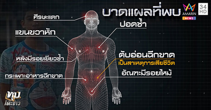 เด็กแฉ เด็กแฉ