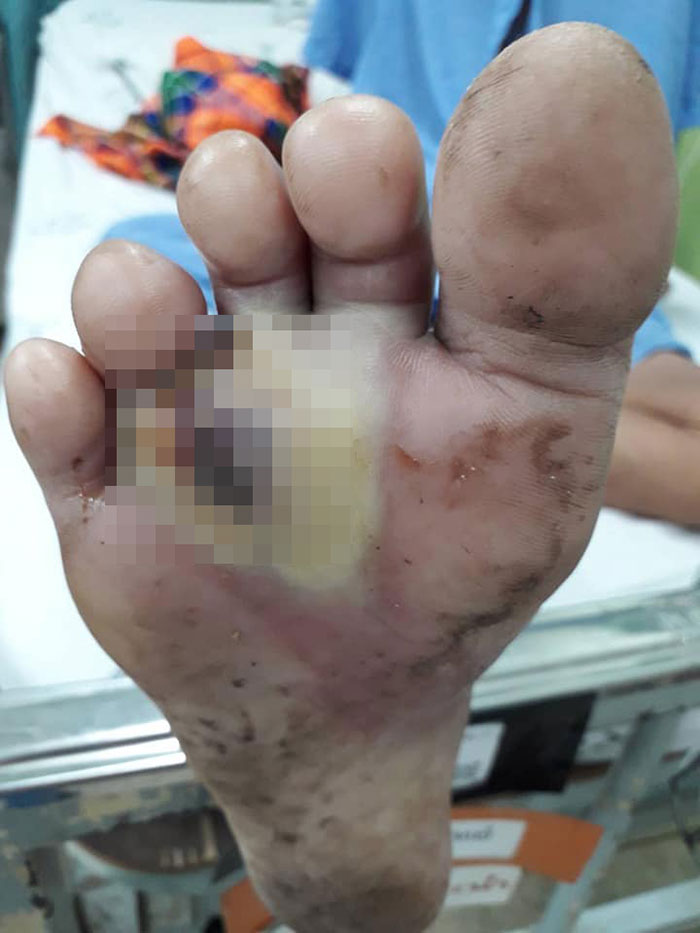 รพ.น่าน รพ.น่าน