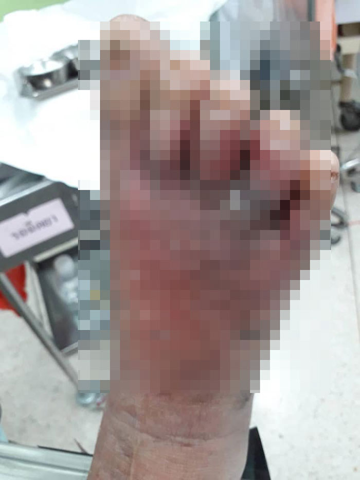 รพ.น่าน รพ.น่าน