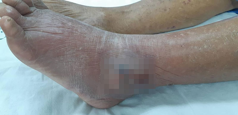 รพ.น่าน รพ.น่าน