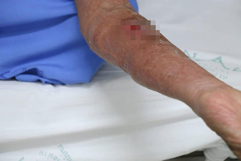 รพ.น่าน รพ.น่าน