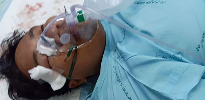 จ่านิว จ่านิว