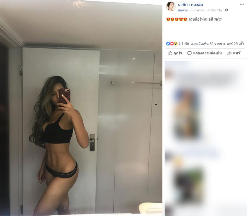 รีวิวศัลยกรรม 6 จุด รีวิวศัลยกรรม 6 จุด