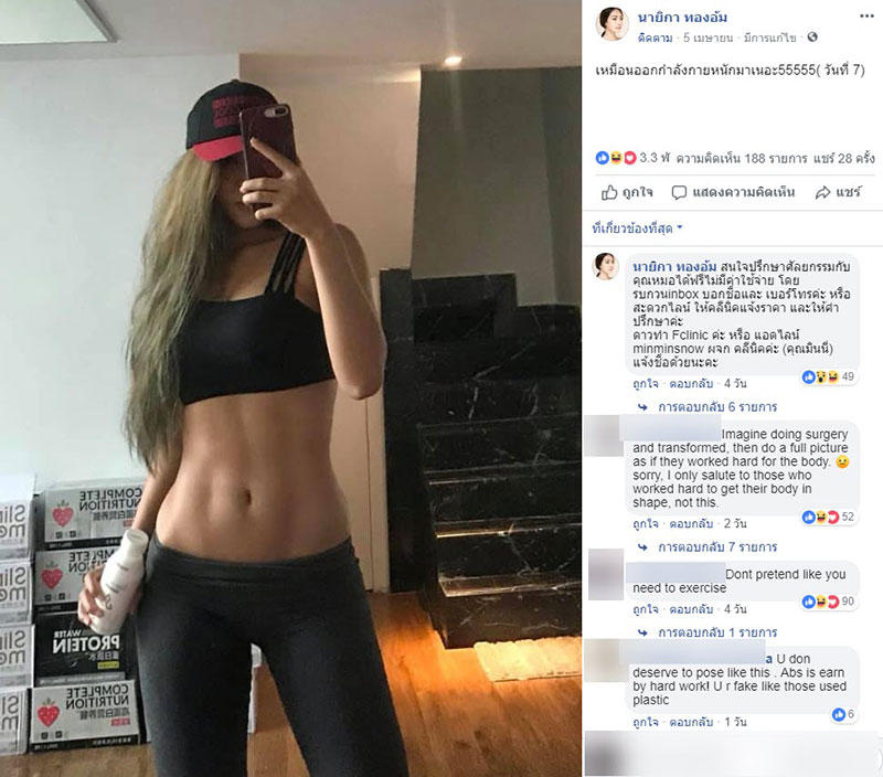 รีวิวศัลยกรรม 6 จุด รีวิวศัลยกรรม 6 จุด