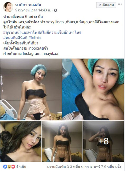 รีวิวศัลยกรรม 6 จุด รีวิวศัลยกรรม 6 จุด
