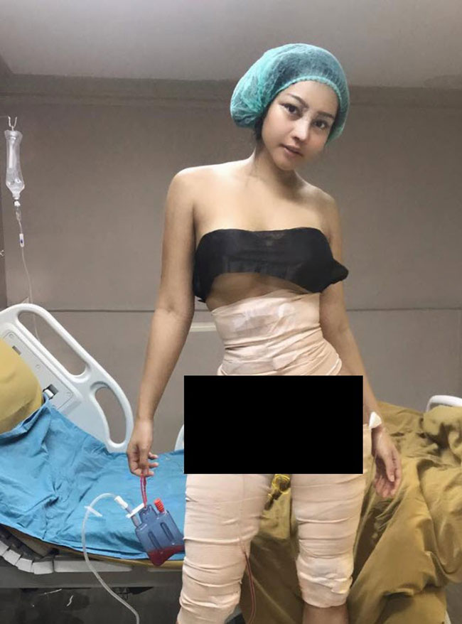 รีวิวศัลยกรรม 6 จุด รีวิวศัลยกรรม 6 จุด