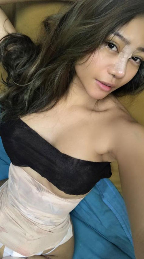 รีวิวศัลยกรรม 6 จุด รีวิวศัลยกรรม 6 จุด