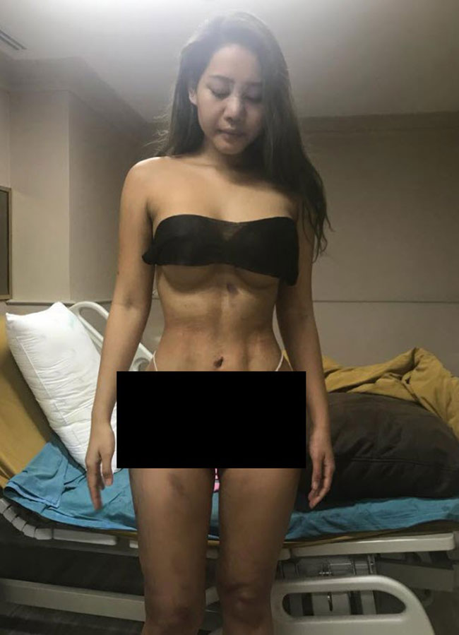 รีวิวศัลยกรรม 6 จุด รีวิวศัลยกรรม 6 จุด