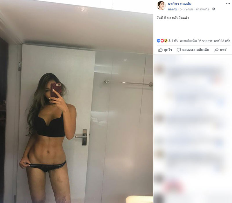 รีวิวศัลยกรรม 6 จุด รีวิวศัลยกรรม 6 จุด