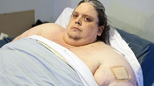 ชายอ้วนที่สุดในโลก หนัก 444 กก. เสียชีวิตแล้ว ด้วยวัย 44 ปี