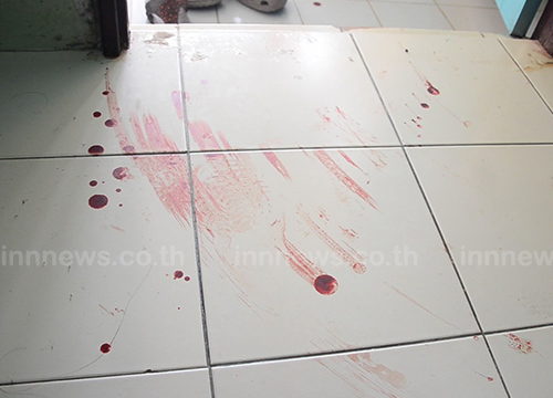 ถูกงูเหลือมฉก ถูกงูเหลือมฉก