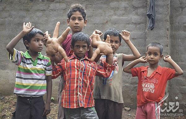 เด็กมือยักษ์ เด็กมือยักษ์