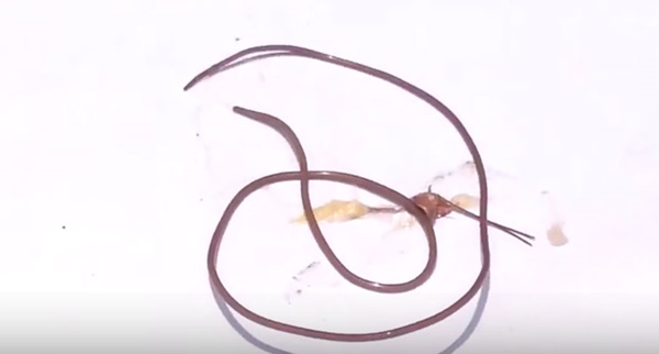 พยาธิขนม้าในแมลง พยาธิขนม้าในแมลง