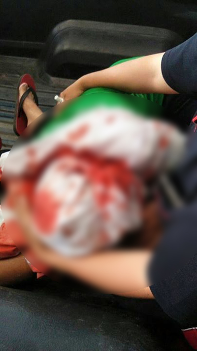 คนงานหญิงผมติดเครื่องจักร คนงานหญิงผมติดเครื่องจักร