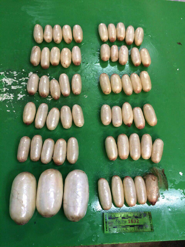 พบสิ่งแปลกปลอมกว่า 50 ก้อน ในท้องศพถูกฆ่ายัดกระเป๋าโยนคลอง พบสิ่งแปลกปลอมกว่า 50 ก้อน ในท้องศพถูกฆ่ายัดกระเป๋าโยนคลอง