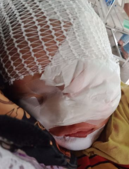 หมากัดเด็ก หมากัดเด็ก