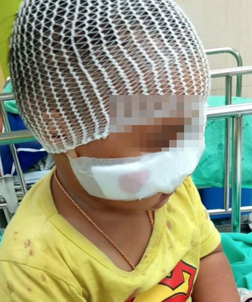 หมากัดเด็ก หมากัดเด็ก