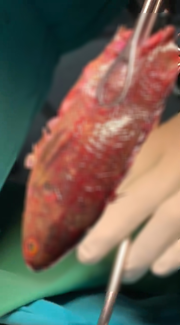 ปลาหมอหลุดลงคอ ปลาหมอหลุดลงคอ