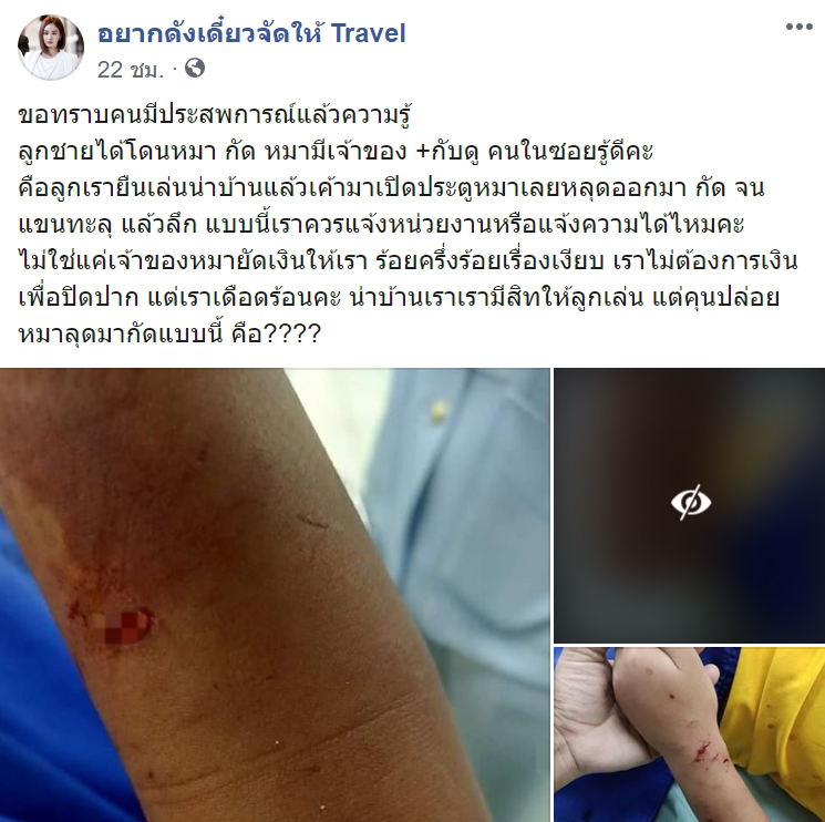 หมากัดเด็ก หมากัดเด็ก