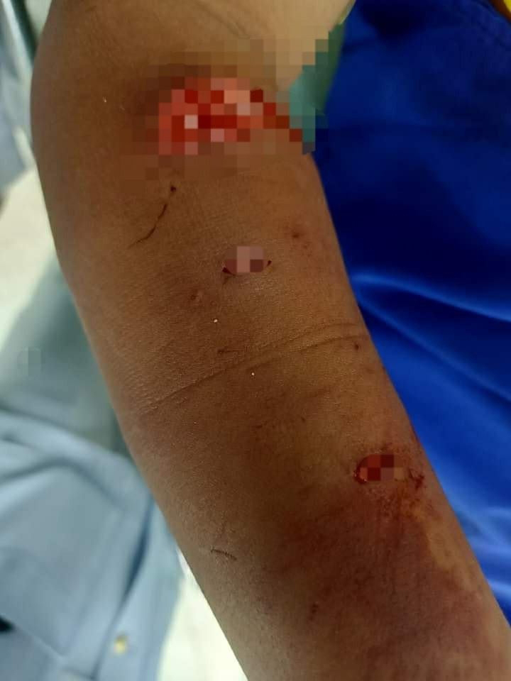 หมากัดเด็ก หมากัดเด็ก