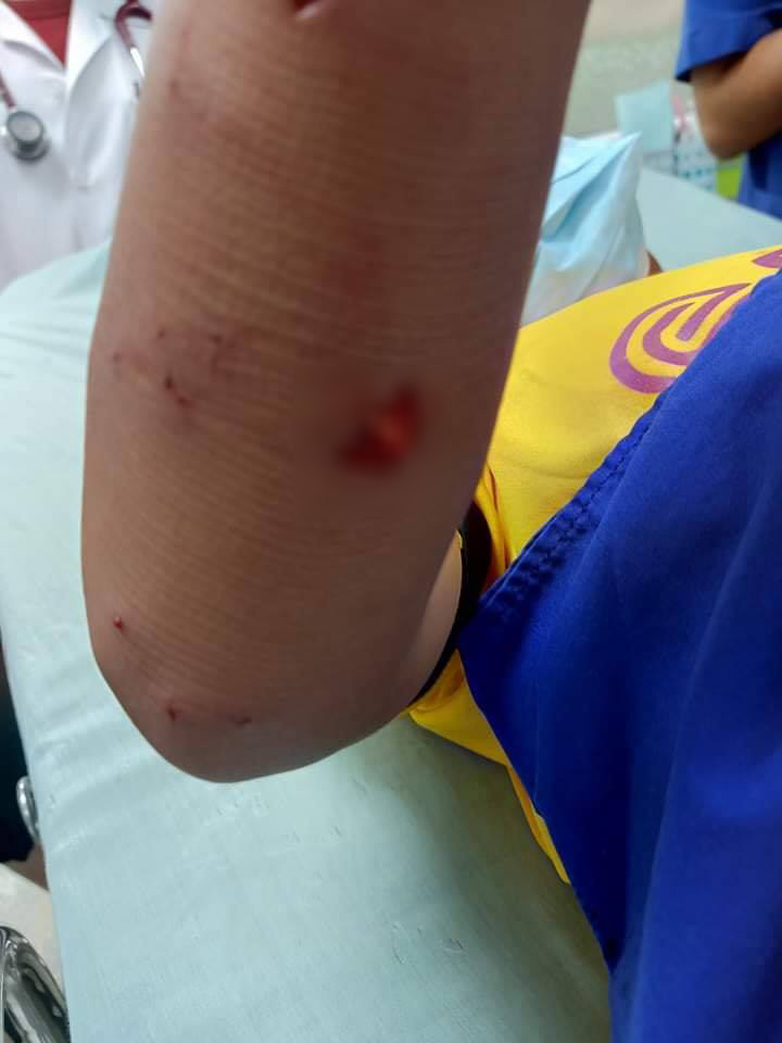 หมากัดเด็ก หมากัดเด็ก