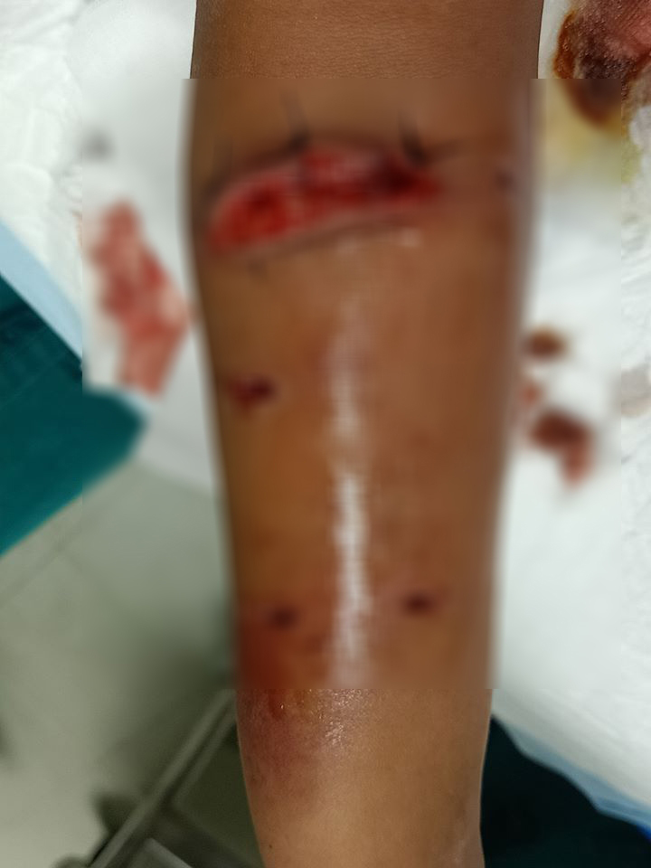 หมากัดเด็ก หมากัดเด็ก