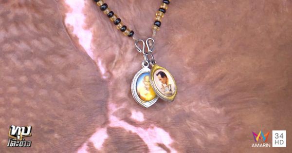 เด็กถูกไฟคลอก เด็กถูกไฟคลอก