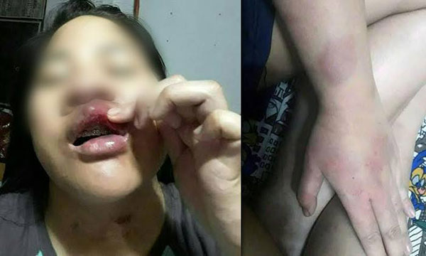 สั่งห้ามหมออนามัยหญิงให้บริการกลางคืน สั่งห้ามหมออนามัยหญิงให้บริการกลางคืน