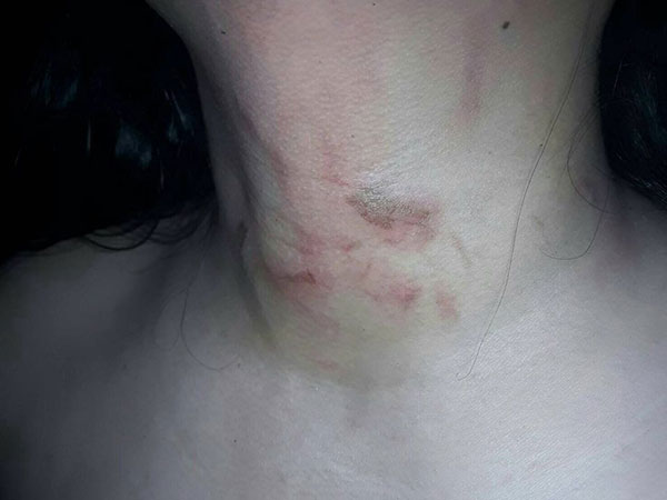 สั่งห้ามหมออนามัยหญิงให้บริการกลางคืน สั่งห้ามหมออนามัยหญิงให้บริการกลางคืน