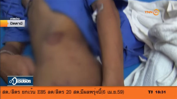 แม่พลทหารเหยื่อรุมซ้อม รับไม่ได้จอสภาพแผลลูก พบถูกเฆี่ยน-รอยเทียนหยดเพียบ แม่พลทหารเหยื่อรุมซ้อม รับไม่ได้จอสภาพแผลลูก พบถูกเฆี่ยน-รอยเทียนหยดเพียบ