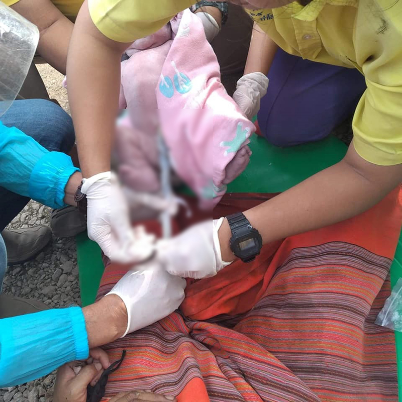 น้องมิ้นต์ สุดยอดเด็ก ม.6 ใช้ความชอบต่อยอด ช่วยทำคลอดสาวกะเหรี่ยง คนชมสนั่น ! น้องมิ้นต์ สุดยอดเด็ก ม.6 ใช้ความชอบต่อยอด ช่วยทำคลอดสาวกะเหรี่ยง คนชมสนั่น !