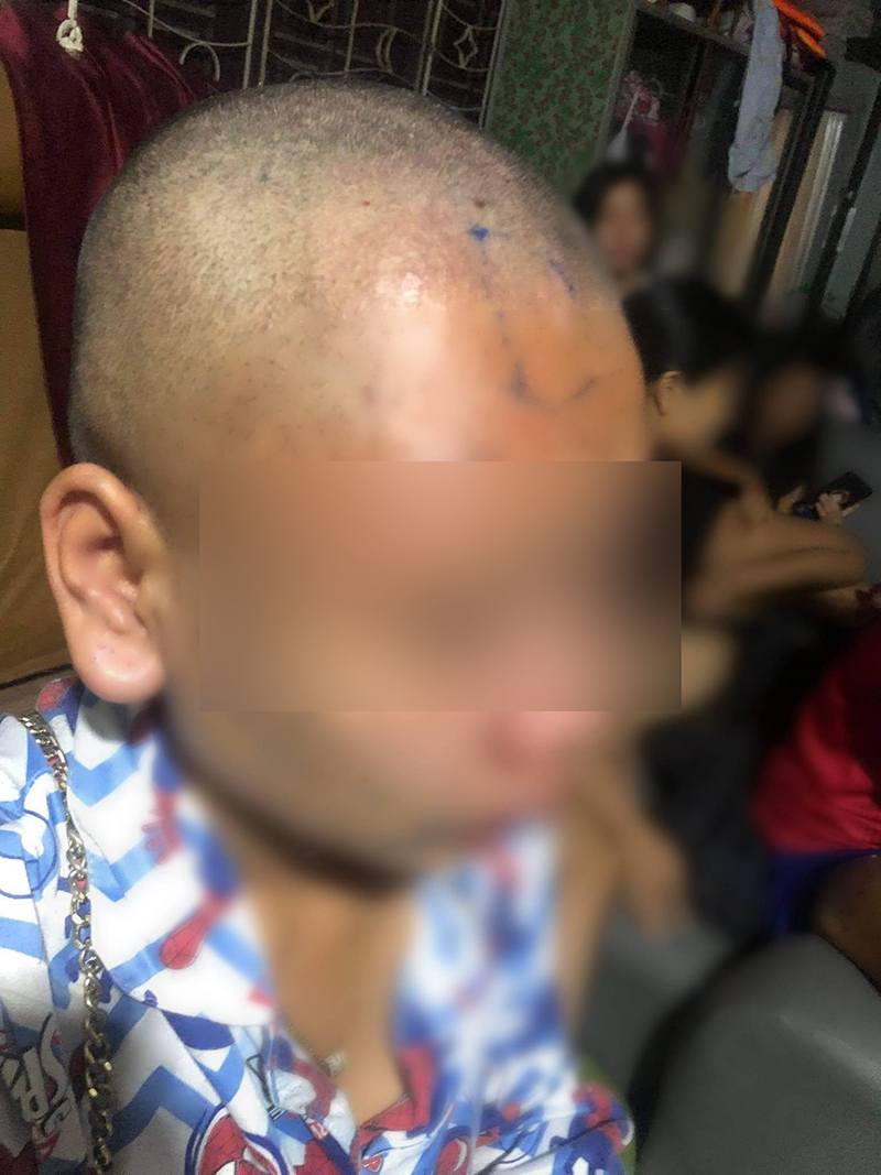 เกินไปไหม !? พริตตี้สาวเจอลวงไปทำร้าย จับโกนผม-คิ้ว ใช้หนี้ 1 หมื่นบาท เกินไปไหม !? พริตตี้สาวเจอลวงไปทำร้าย จับโกนผม-คิ้ว ใช้หนี้ 1 หมื่นบาท