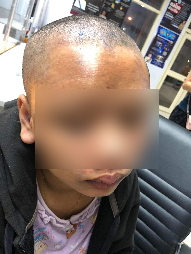 เกินไปไหม !? พริตตี้สาวเจอลวงไปทำร้าย จับโกนผม-คิ้ว ใช้หนี้ 1 หมื่นบาท เกินไปไหม !? พริตตี้สาวเจอลวงไปทำร้าย จับโกนผม-คิ้ว ใช้หนี้ 1 หมื่นบาท