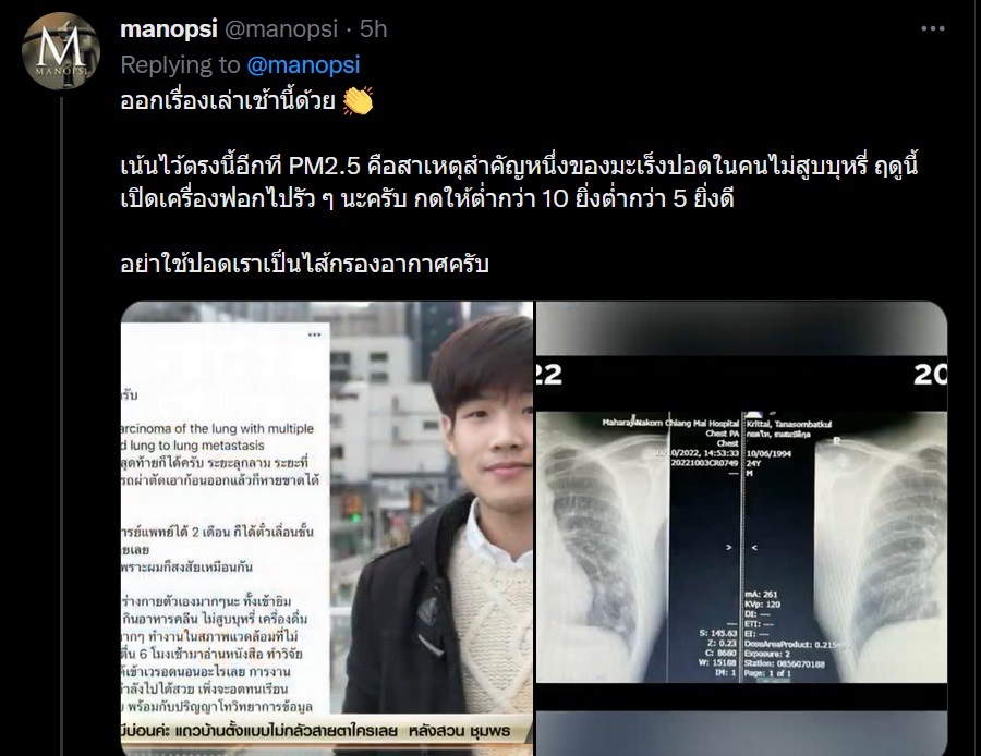 คาดสาเหตุที่หมอกฤตไท เป็นมะเร็งปอด ทั้งที่อายุ 28 ดูแลร่างกายอย่างดี ภัยใกล้ตัวกว่าที่คิด คาดสาเหตุที่หมอกฤตไท เป็นมะเร็งปอด ทั้งที่อายุ 28 ดูแลร่างกายอย่างดี ภัยใกล้ตัวกว่าที่คิด